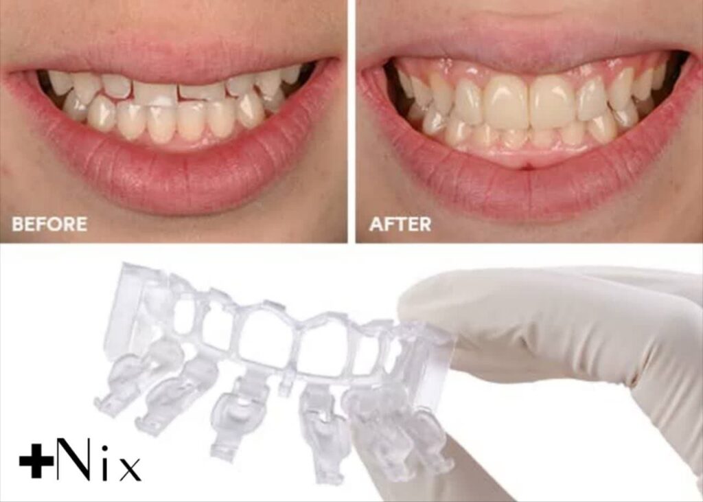 مزایا و معایب کامپوزیت