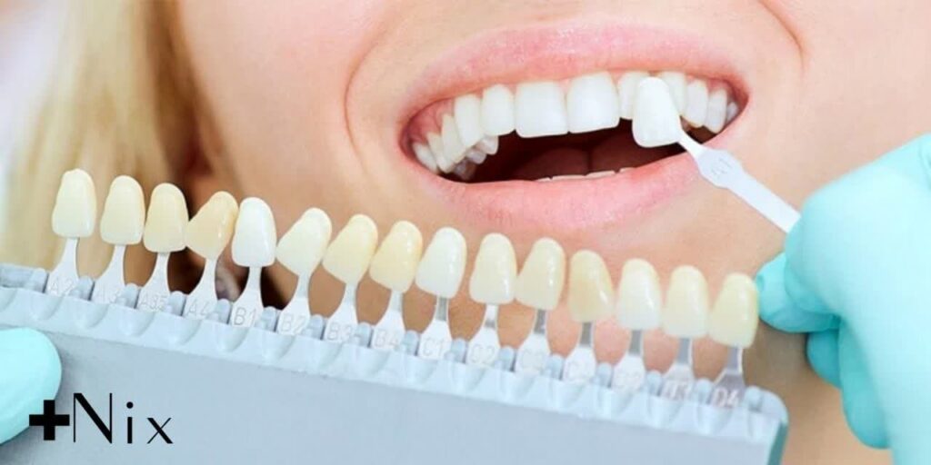 انواع کامپوزیت دندان و کاربردهای آن