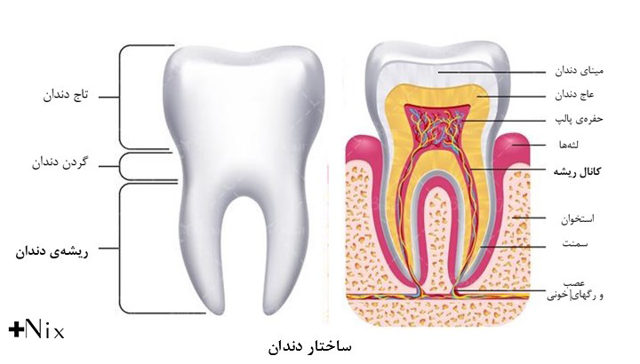 درمان ریشه دندان