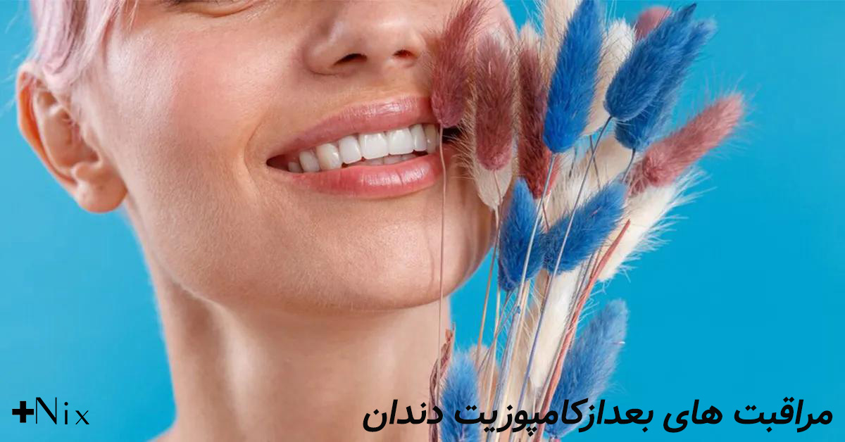 رژیم غذایی بعد از کامپوزیت