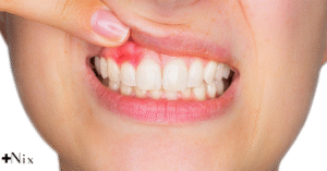 انواع دندان درد