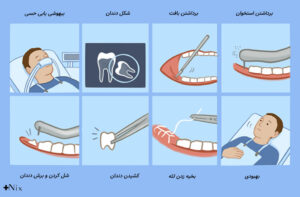مراقبت بعد از جراحی دندان عقل
